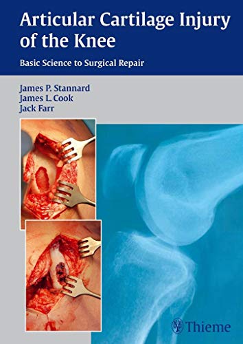 Imagen de archivo de Articular Cartilage Injury of the Knee: Basic Science to Surgical Repair a la venta por Y-Not-Books