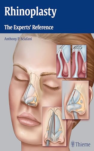 9781604068672: Rhinoplasty: The Experts' Reference