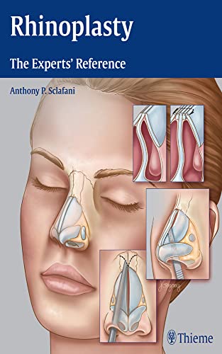 9781604068672: Rhinoplasty: The Experts' Reference