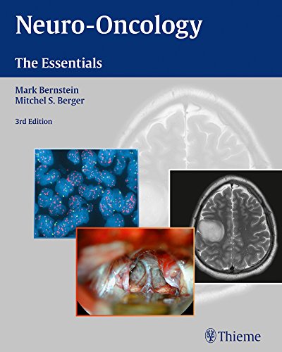 9781604068832: Neuro-Oncology: The Essentials