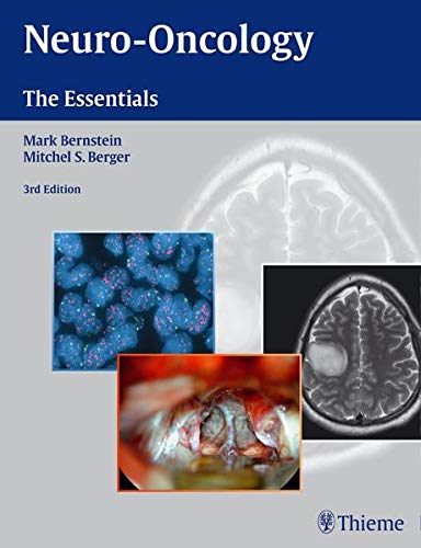9781604068849: Neuro-Oncology: The Essentials