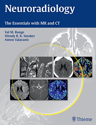 Stock image for Neuroradiology: The Essentials with MR and CT for sale by GF Books, Inc.