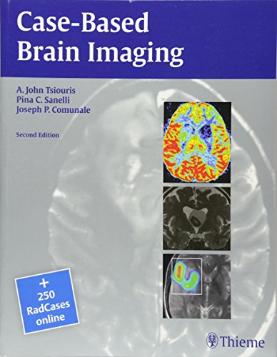 9781604069532: Case-Based Brain Imaging