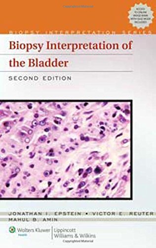 Biopsy Interpretation of the Bladder (Biopsy Interpretation Series) (9781605473352) by Epstein, Jonathan I., M.D.; Amin, Mahul B.; Reuter, Victor E., M.D.