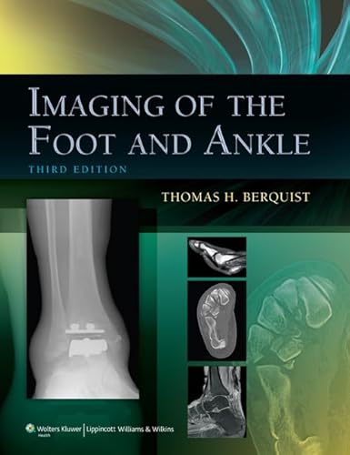 Stock image for Imaging of the Foot & Ankle 3/e for sale by Romtrade Corp.