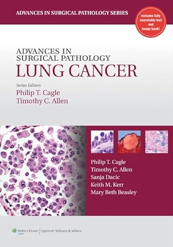 Stock image for Advances in Surgical Pathology: Lung Cancer (Advances in Surgical Pathology Series) for sale by HPB-Red