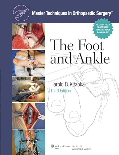 Stock image for Master Techniques in Orthopaedic Surgery: The Foot and Ankle for sale by Anybook.com