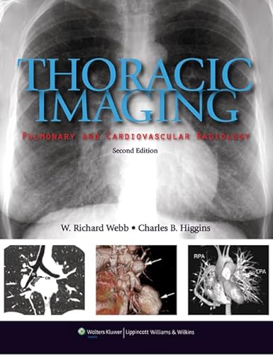 Imagen de archivo de Thoracic Imaging: Pulmonary and Cardiovascular Radiology a la venta por dsmbooks