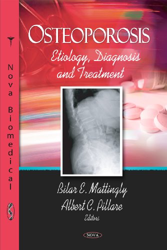 Stock image for Osteoporosis: Etiology, Diagnosis and Treatment: Etiology, Diagnosis & Treatment for sale by Anybook.com