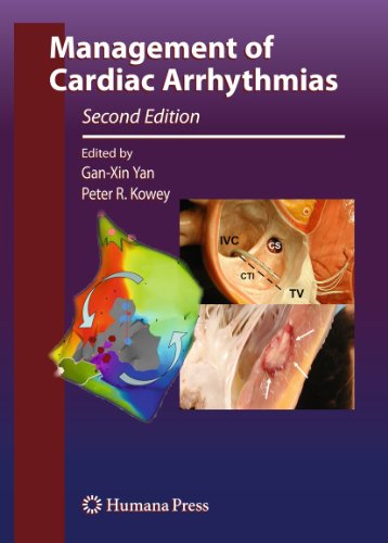 Stock image for Management of Cardiac Arrhythmias. Second edition for sale by Research Ink