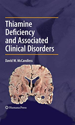 Thiamine Deficiency And Associated Clinical Disorders