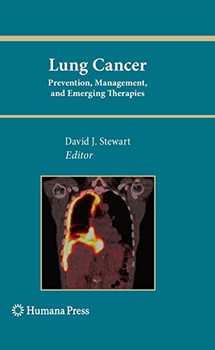 9781607615231: Lung Cancer:: Prevention, Management, and Emerging Therapies (Current Clinical Oncology)