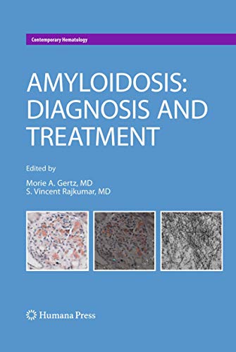 9781607616306: Amyloidosis: Diagnosis and Treatment (Contemporary Hematology)
