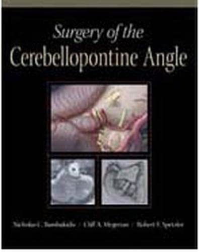 Imagen de archivo de Surgery of the Cerebellopontine Angle a la venta por suspiratio - online bcherstube