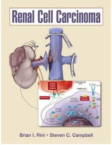 Stock image for Renal Cell Carcinoma (Hb 2009) for sale by Urban Book Limited