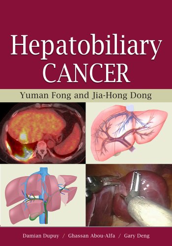 Hepatobiliary Cancer (9781607950165) by Fong, Yuman, M.D.; Dong, Jia-Hong, M.D.