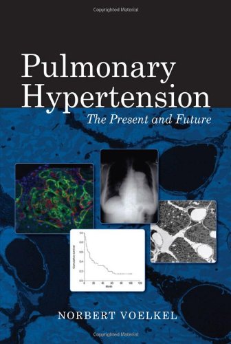 Stock image for Pulmonary Hypertension for sale by suffolkbooks