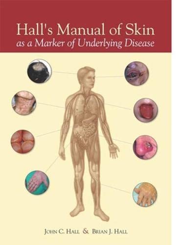 Imagen de archivo de Hall S Manual Of Skin As A Marker Of Underlying Disease a la venta por Romtrade Corp.