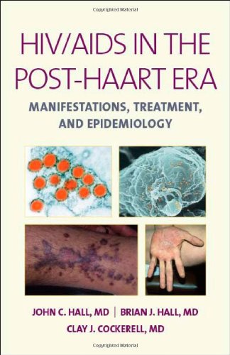 Imagen de archivo de Hiv Aids In The Post Haart Era Manifestations Treatment And Epidemiology (Hb 2011) a la venta por Romtrade Corp.