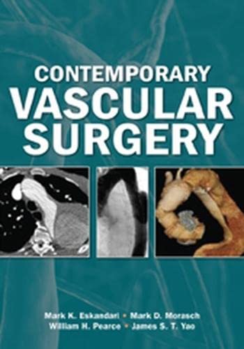 Imagen de archivo de Contemporary Vascular Surgery a la venta por Decluttr