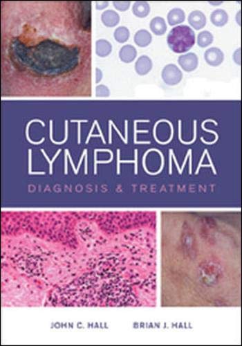 Imagen de archivo de Cutaneous Lymphoma Diagnosis And Treatmnet (Hb 2012) a la venta por Romtrade Corp.