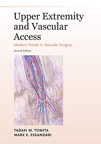 Stock image for Upper Extremity and Vascular Access (Modern Trends in Vascular Surgery) for sale by suffolkbooks