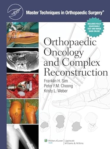9781608310432: Master Techniques in Orthopaedic Surgery: Orthopaedic Oncology and Complex Reconstruction