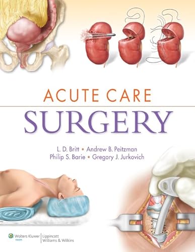 Imagen de archivo de Acute Care Surgery a la venta por Books From California