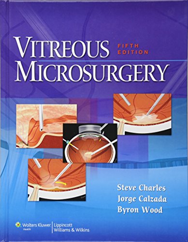 Imagen de archivo de Vitreous Microsurgery a la venta por Better World Books