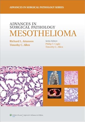 Stock image for Advances in Surgical Pathology: Mesothelioma for sale by GoldenWavesOfBooks