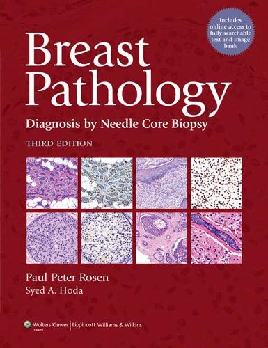 Stock image for Breast Pathology: Diagnosis by Needle Core Biopsy for sale by More Than Words