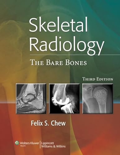 Stock image for Skeletal Radiology: The Bare Bones for sale by HPB-Red