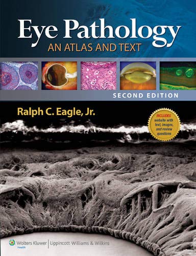 9781608317882: Eye Pathology: An Atlas and Text