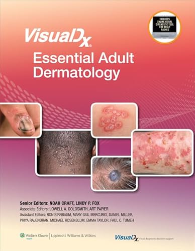 Stock image for VisualDx: Essential Adult Dermatology (VisualDx: The Modern Library of Visual Medicine) for sale by Wizard Books
