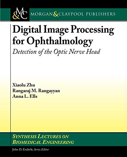 9781608456314: Digital Image Processing for Ophthalmology: Detection of the Optic Nerve Head (Synthesis Lectures on Biomedical Engineering)