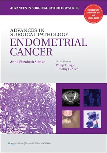 Imagen de archivo de Advances in Surgical Pathology: Endometrial Carcinoma a la venta por Buyback Express