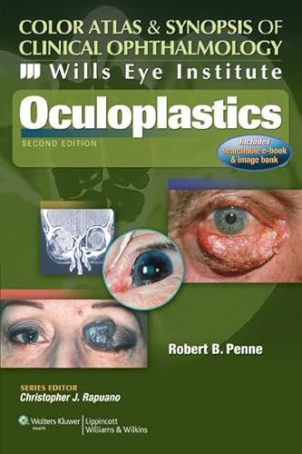 Stock image for Color Atlas Synopsis of Clinical Ophthalmology: Wills Eye Institute - Oculoplastics (Wills Eye Institute Atlas Series) for sale by GoldenWavesOfBooks