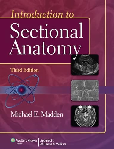 9781609139612: Introduction to Sectional Anatomy (Point (Lippincott Williams & Wilkins))