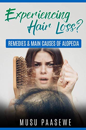 Stock image for EXPERIENCING HAIR LOSS?: REMEDIES & MAIN CAUSES OF ALOPECIA for sale by WorldofBooks