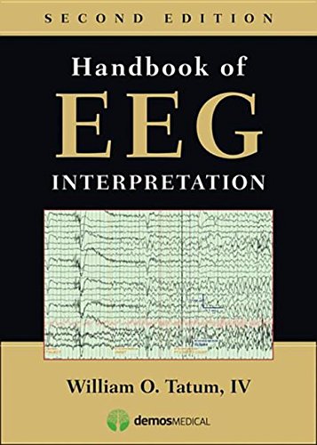 9781617051807: Handbook of Eeg Interpretation, 2nd Ed