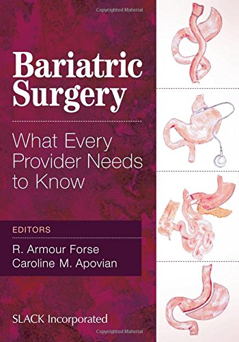 Stock image for Bariatric Surgery for sale by Blackwell's