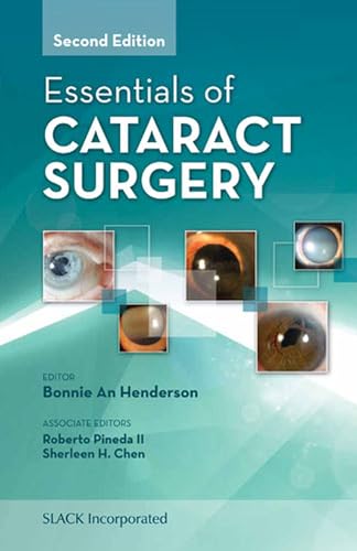 9781617110672: Essentials of Cataract Surgery
