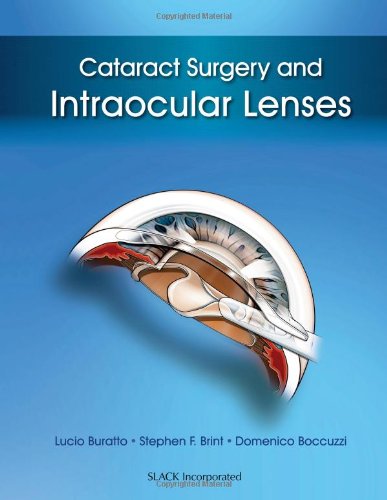 Imagen de archivo de Cataract Surgery and Intraocular Lenses a la venta por PBShop.store US