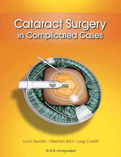 Imagen de archivo de Cataract Surgery in Complicated Cases a la venta por dsmbooks