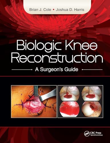 9781617118166: Biologic Knee Reconstruction: A Surgeon's Guide