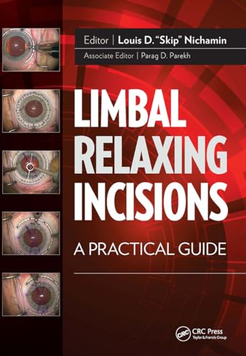 9781617118388: Limbal Relaxing Incisions: A Practical Guide