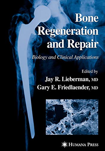 9781617372193: Bone Regeneration and Repair: Biology and Clinical Applications