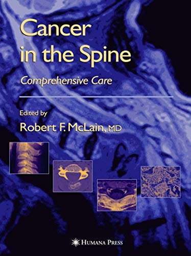 9781617373404: Cancer in the Spine: Comprehensive Care (Current Clinical Oncology)
