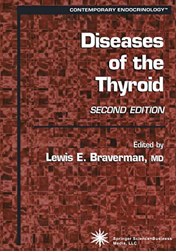 9781617374050: Diseases of the Thyroid (Contemporary Endocrinology)
