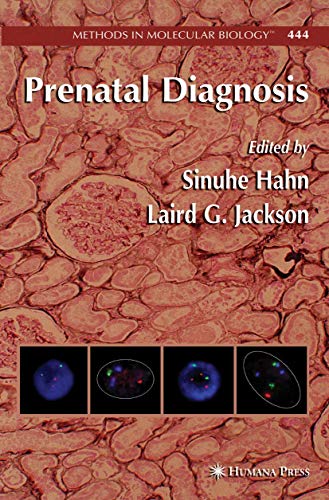 9781617377877: Prenatal Diagnosis (Methods in Molecular Biology, 444)